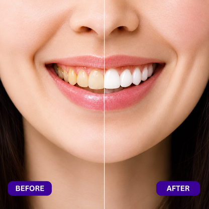 PurpleGlow™ Mouthwash